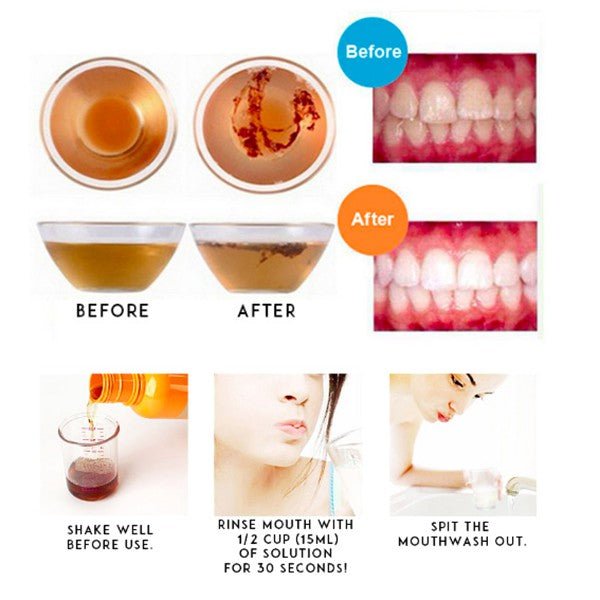 Propolinse Natural Oral Mouth Wash from Japan - Original 600ml - NANA MALL