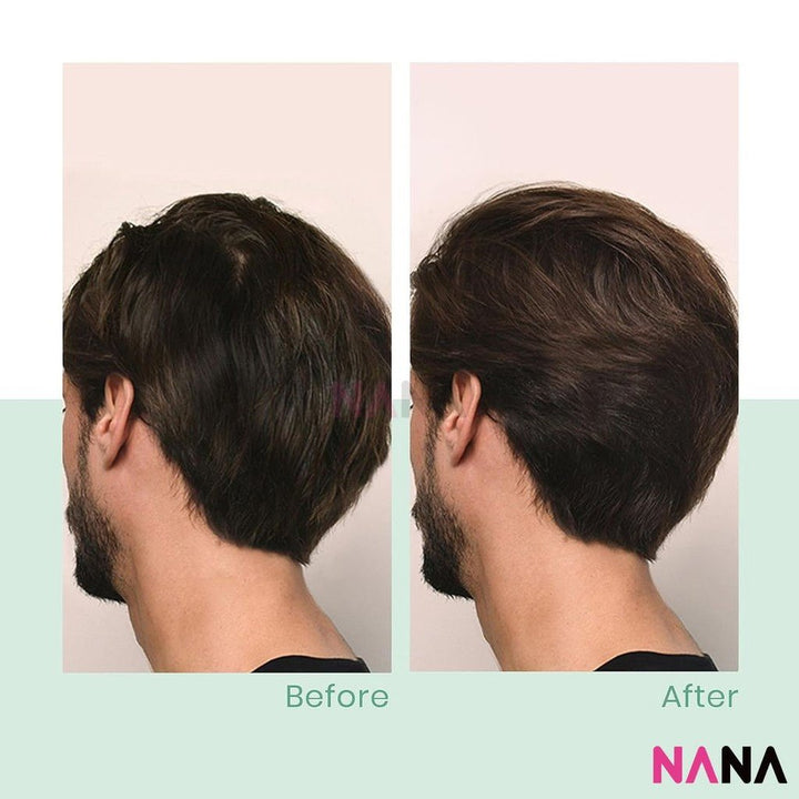 Rene Furterer Triphasic Thickening Anti Hair Loss Shampoo 250ml - NANA MALL