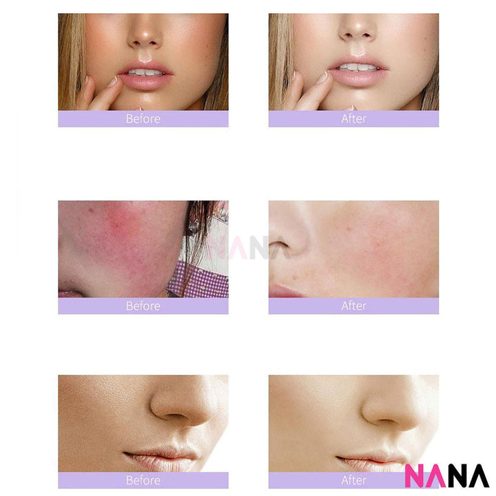 Eaoron Miracle Soothing Mask (5 Sheets/ Box) - NANA MALL