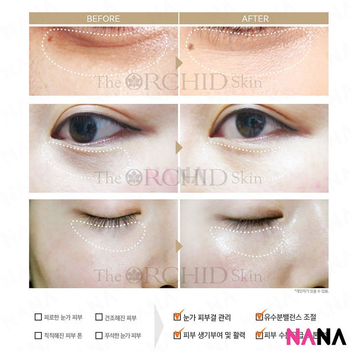 The Orchid Skin Orchid Elastic Under Youth Eye Patch (10 pairs) [Plus Upgrade] - NANA MALL