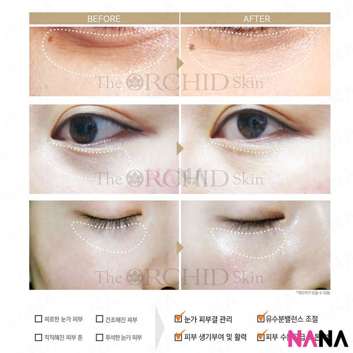 The Orchid Skin Orchid Smoky Under Clear Eye Patch (10 pairs) [Plus Upgrade] x 2 - NANA MALL