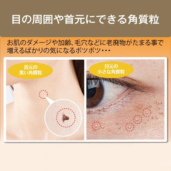 Tsubu Night Pack Wart Remover Cream 30g - NANA MALL