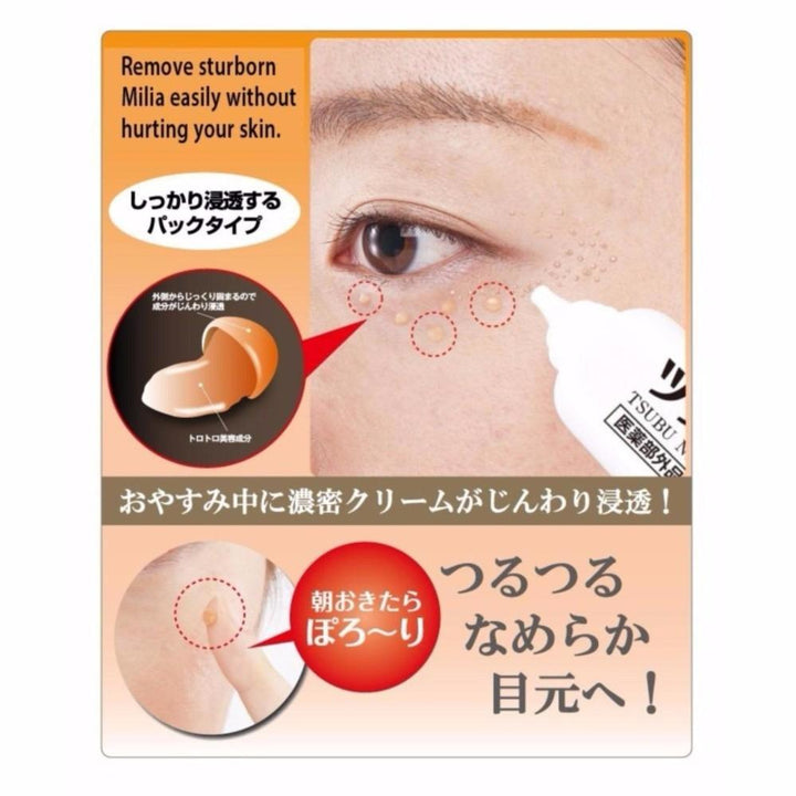 Tsubu Night Pack Wart Remover Cream 30g - NANA MALL